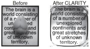 A "clarified" brain (lipids removed, everything else in place). Transparent to optical microscopy, all the proteins, receptors, RNAs able to be repetitively interrogated with molecular probes. Amazing!